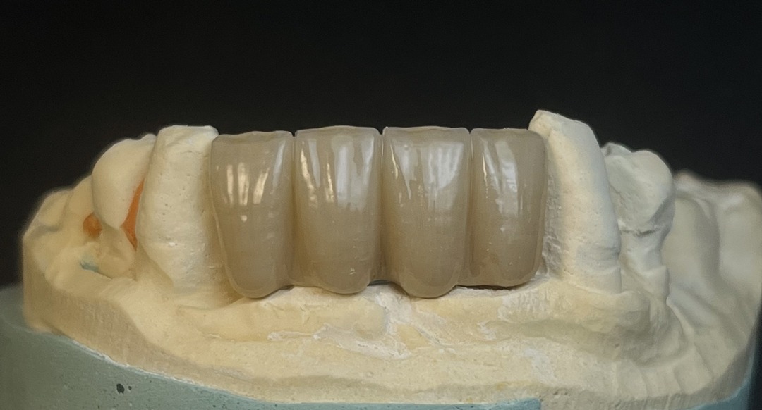 Resultado-final-gcf-dental-modelo