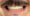 gcf-dental-lab-final-boca-